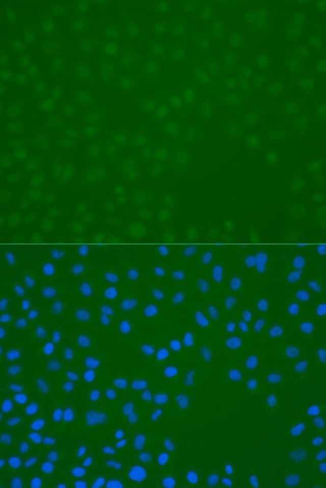 Anti-Phospho-CHEK1-S296 antibody produced in rabbit