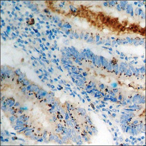 Anti-phospho-Cortactin (pTyr<sup>466</sup>) antibody produced in rabbit