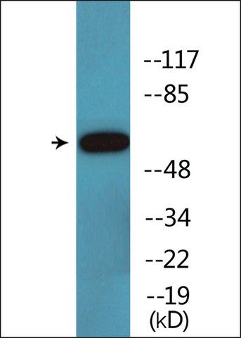 Anti-phospho-Cortactin (pTyr<sup>421</sup>) antibody produced in rabbit