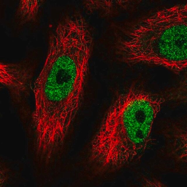 Anti-PHF12 antibody produced in rabbit