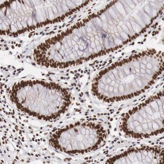 Anti-PHF14 antibody produced in rabbit