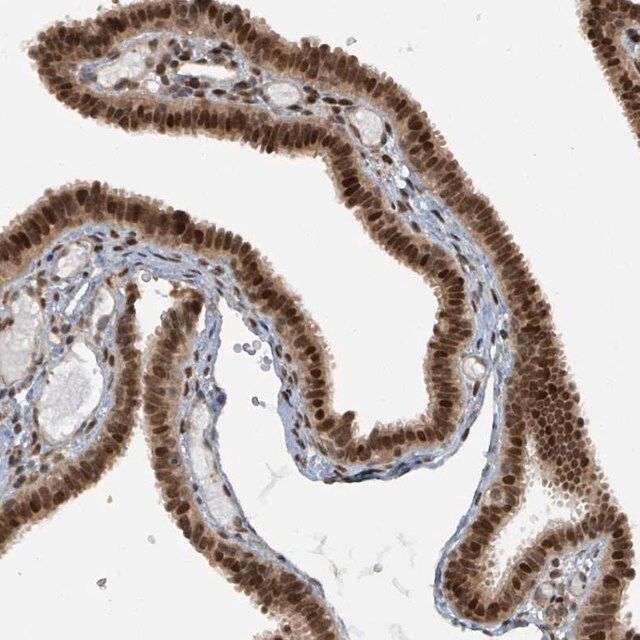 Anti-PHIP antibody produced in rabbit