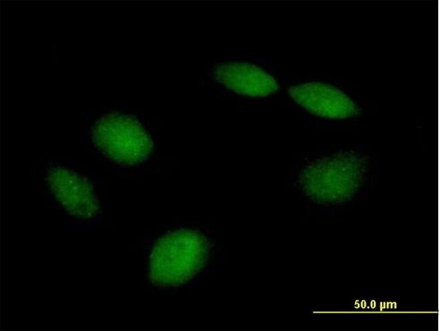 Anti-PHF21B antibody produced in mouse