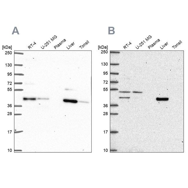 Anti-PHKG2 antibody produced in rabbit