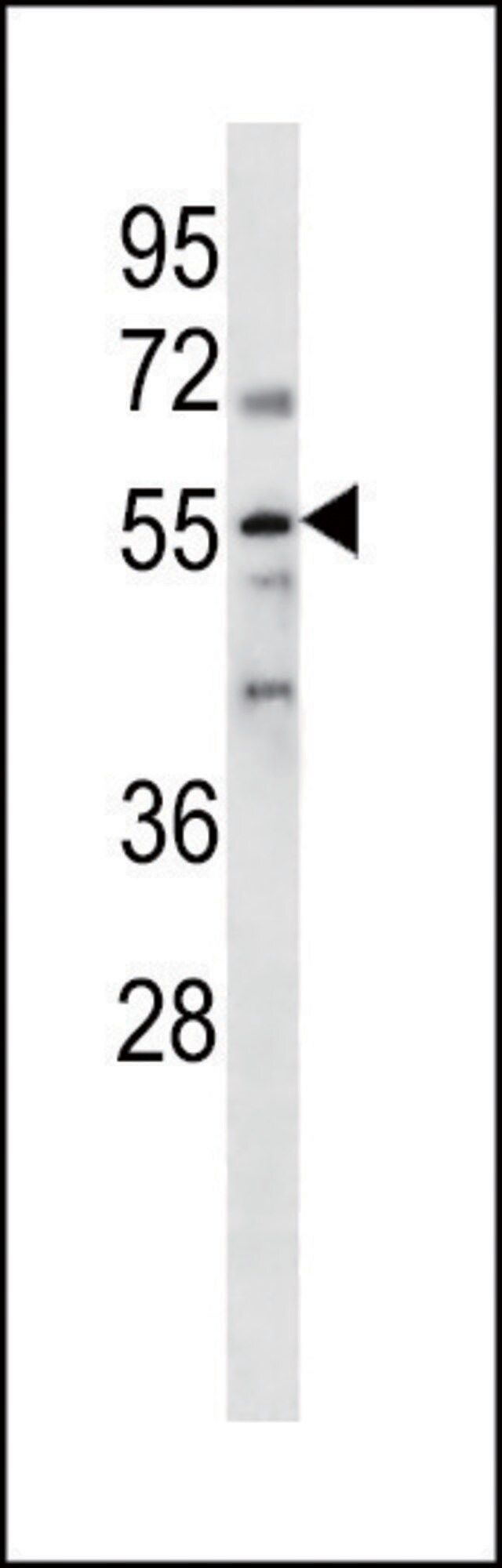 ANTI-PARP2 (N-TERM) antibody produced in rabbit