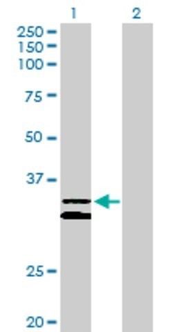 Anti-PCDH1 antibody produced in rabbit