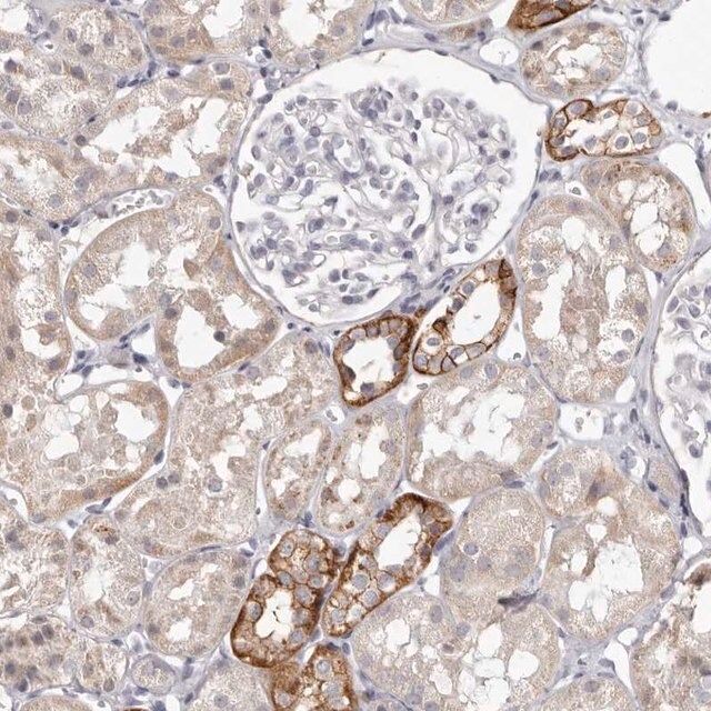 Anti-PCDHB6 antibody produced in rabbit