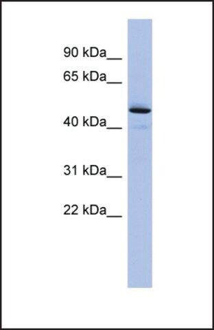 Anti-PCOLCE antibody produced in rabbit