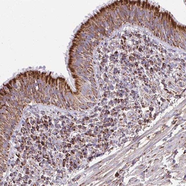 Anti-PCMTD2 antibody produced in rabbit