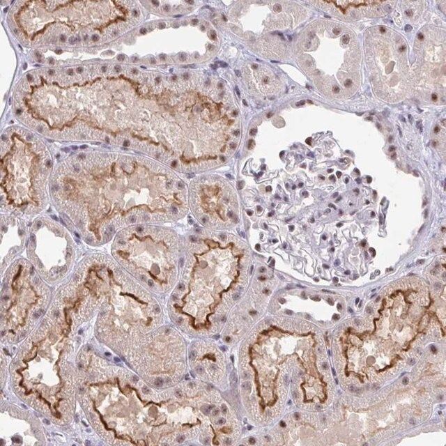 Anti-OR6K3 antibody produced in rabbit