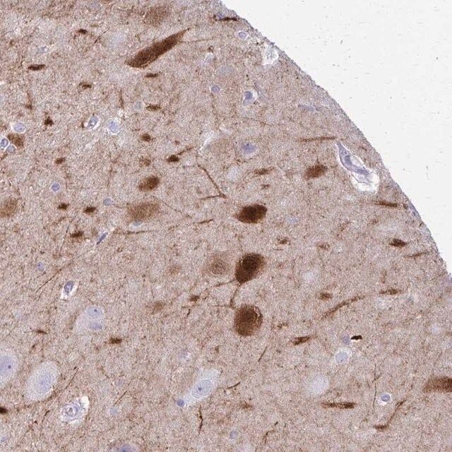 Anti-OR4M2 antibody produced in rabbit