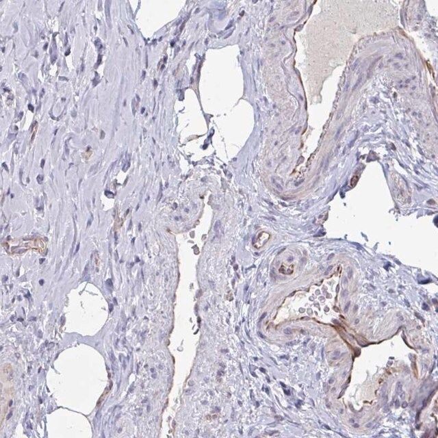 Anti-OR1L3 antibody produced in rabbit