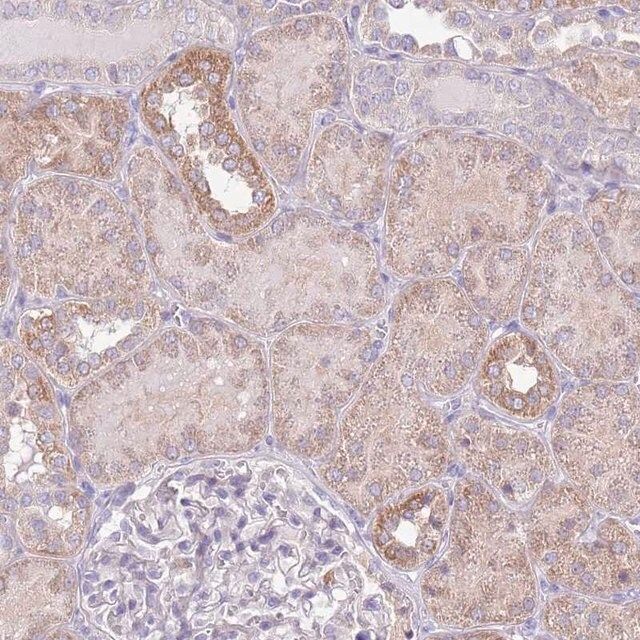 Anti-OR6M1 antibody produced in rabbit