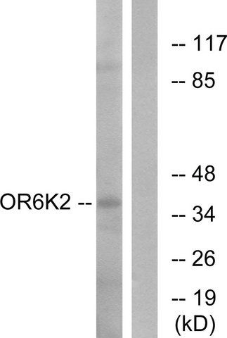 Anti-OR6K2 antibody produced in rabbit