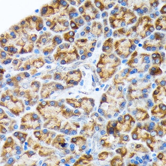 Anti-ORP150/GRP170/HSP12A antibody produced in rabbit