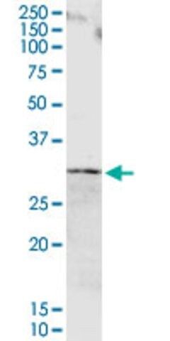 Anti-ORM1 antibody produced in rabbit