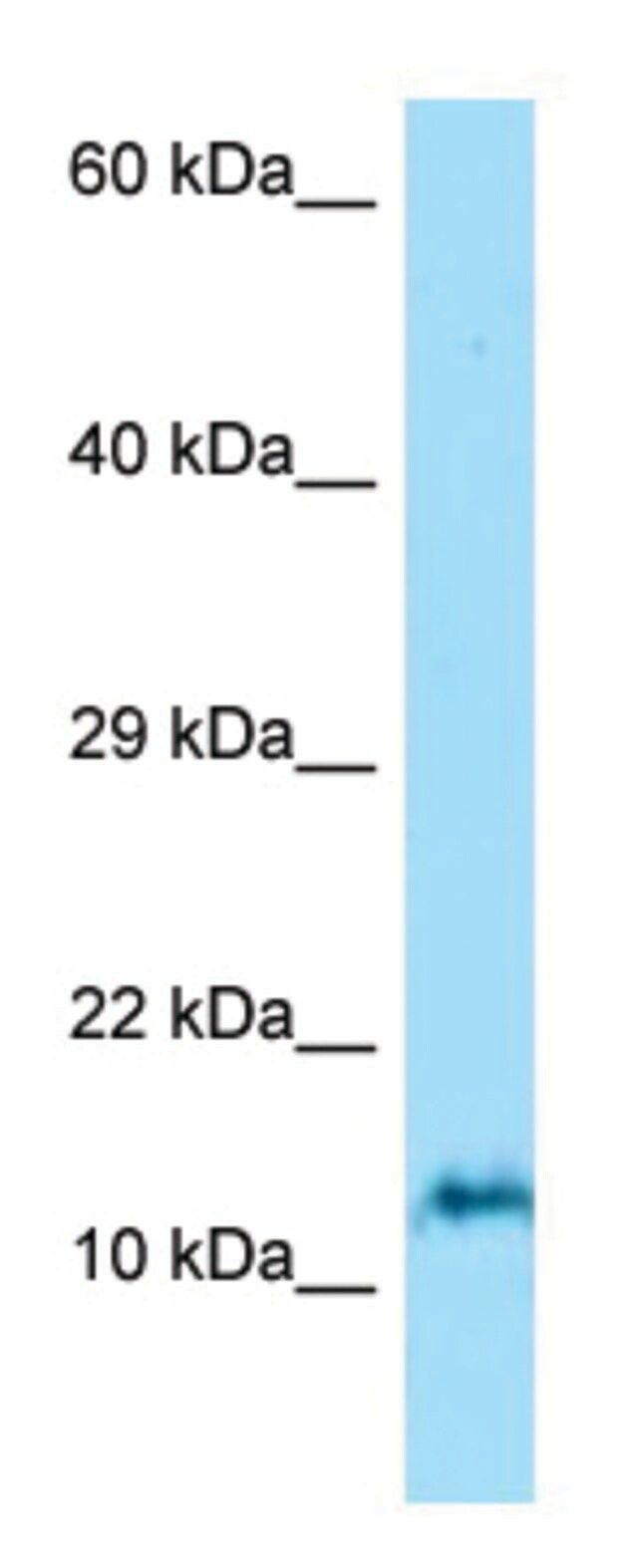 Anti-ORMDL3 (N-terminal) antibody produced in rabbit