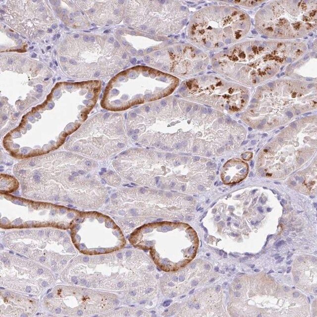 Anti-OR6N2 antibody produced in rabbit