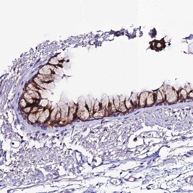 Anti-OR51Q1 antibody produced in rabbit