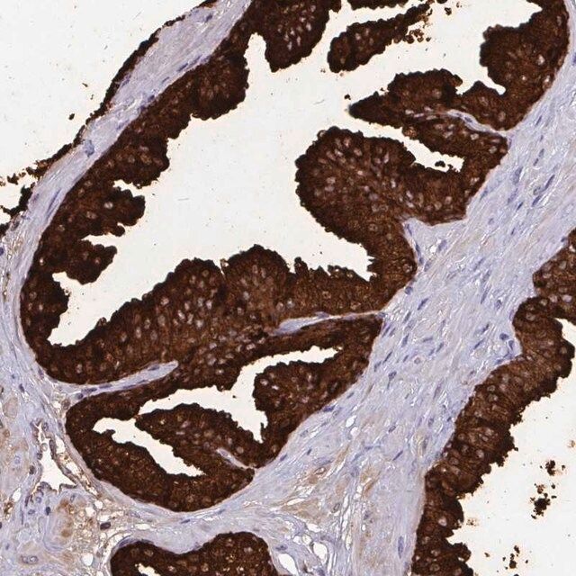 Anti-OR10R2 antibody produced in rabbit