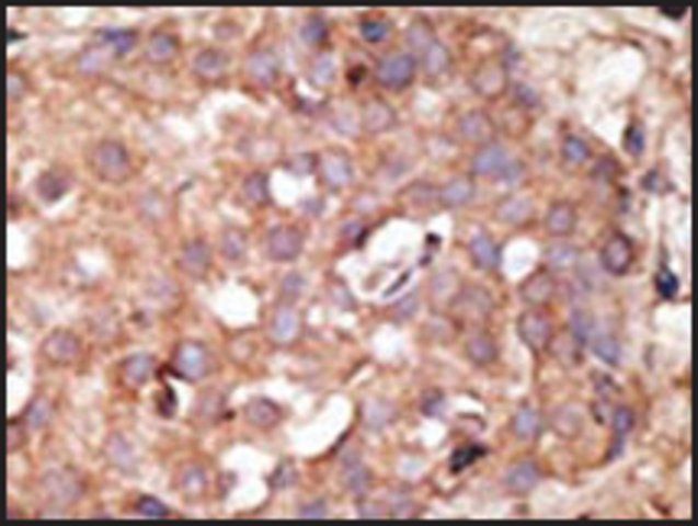 Anti-NYREN18 (N-term) antibody produced in rabbit