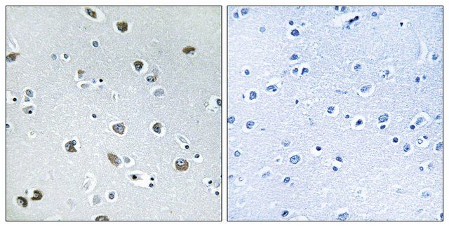 Anti-NXPH4 antibody produced in rabbit