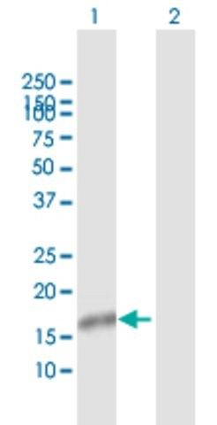 Anti-NXT1 antibody produced in rabbit