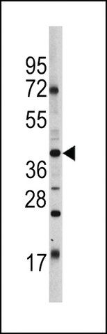 ANTI-OCT4 (OCT3) (E125) antibody produced in rabbit