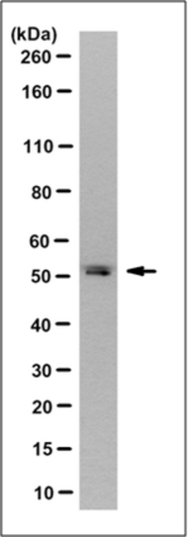 Anti-OAS1 Antibody, clone 1D11.1