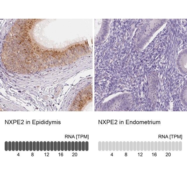 Anti-NXPE2 antibody produced in rabbit