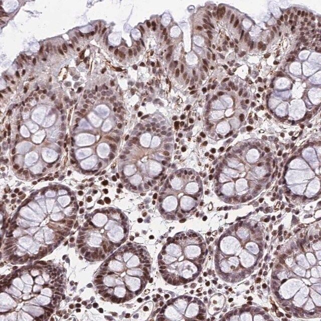 Anti-NYAP2 antibody produced in rabbit