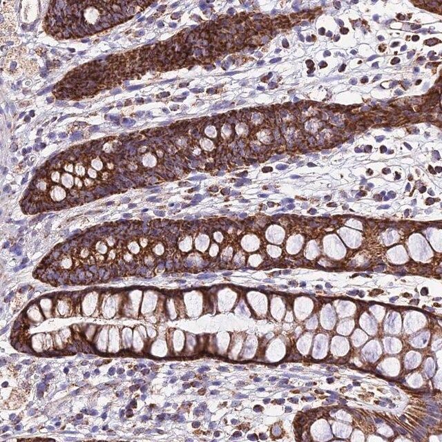 Anti-OCIAD1 antibody produced in rabbit