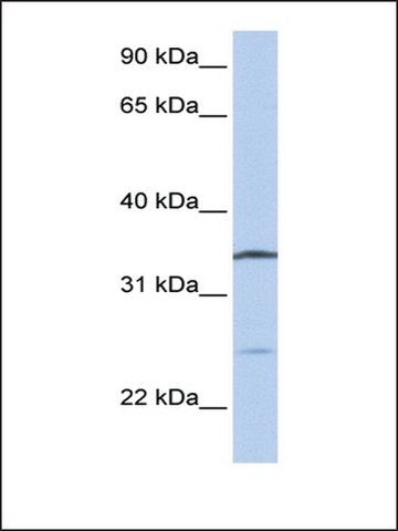 Anti-OCIAD1 antibody produced in rabbit