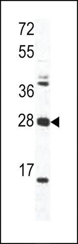 ANTI-OAZ1(N-TERMINAL) antibody produced in rabbit