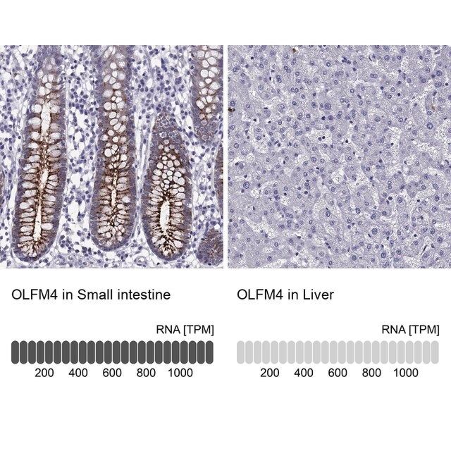 Anti-OLFM4