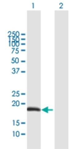 Anti-ODAM antibody produced in mouse