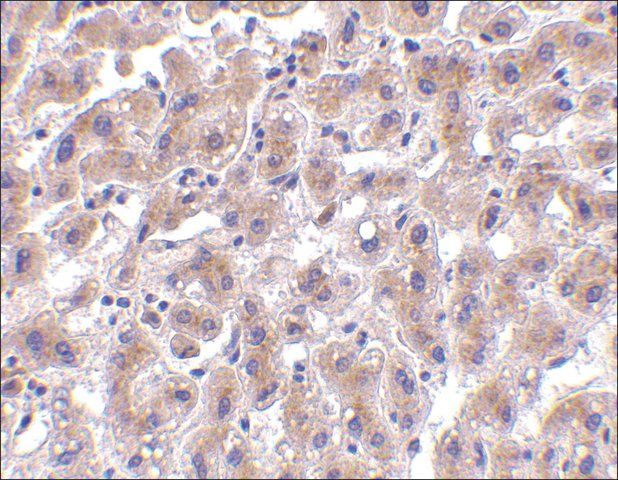 Anti-OMI (ab1) antibody produced in rabbit