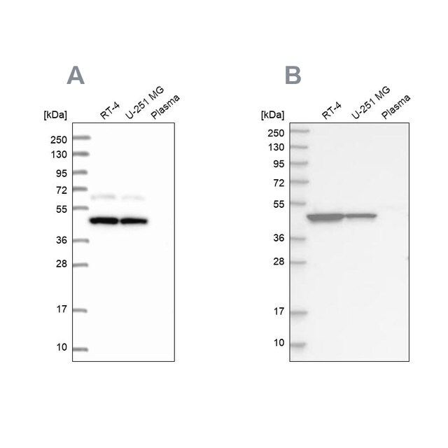 Anti-OLA1 antibody produced in rabbit