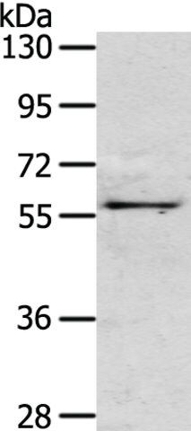 Anti-OLFM3