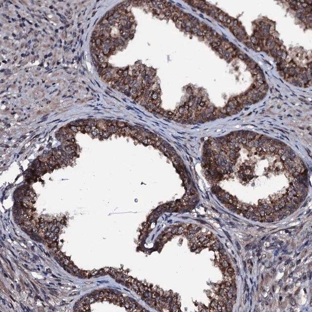 Anti-OGFOD2 antibody produced in rabbit