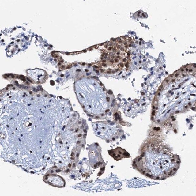 Anti-OLAH antibody produced in rabbit