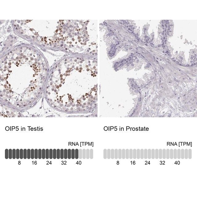 Anti-OIP5 antibody produced in rabbit