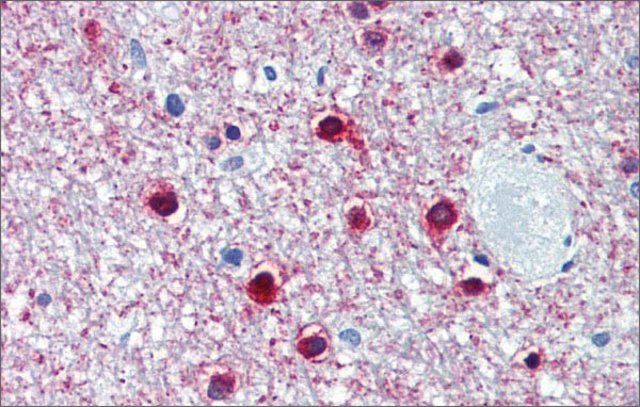 Anti-ONECUT1 (ab2) antibody produced in rabbit