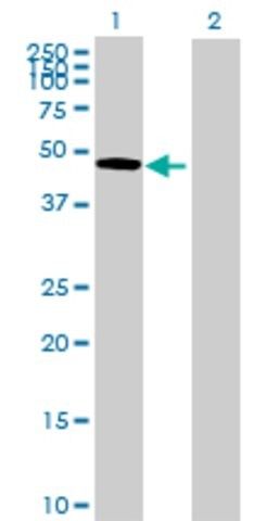 Anti-OMD antibody produced in mouse