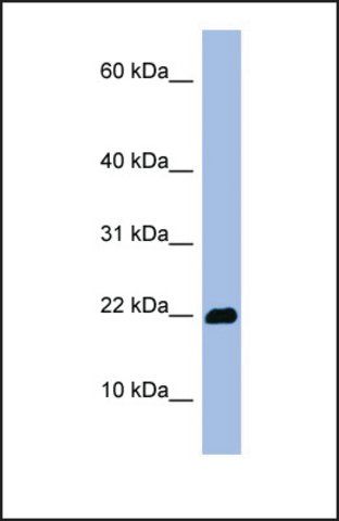 Anti-OMP antibody produced in rabbit