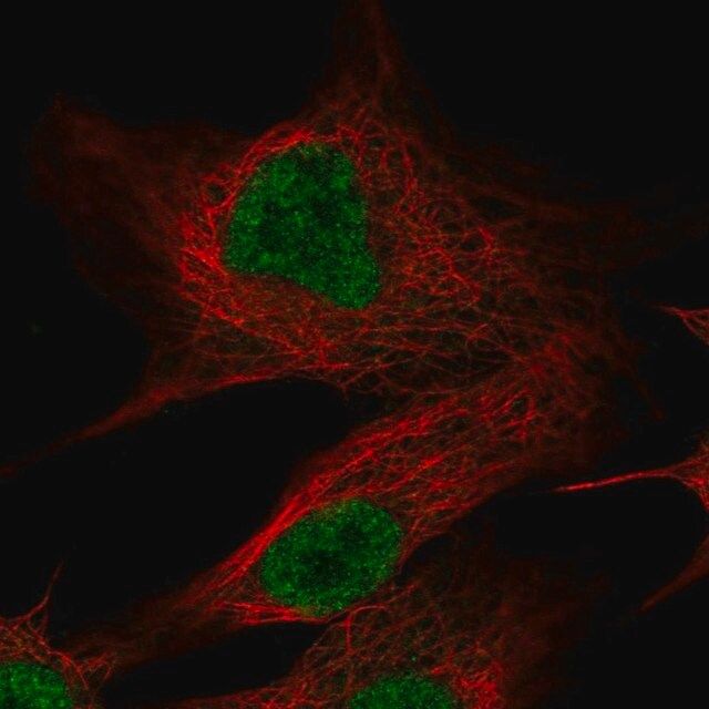 Anti-OLFM2 antibody produced in rabbit