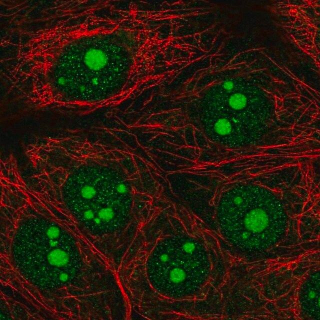 Anti-OLFM1 antibody produced in rabbit