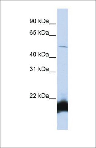 Anti-ONECUT1 (ab1) antibody produced in rabbit