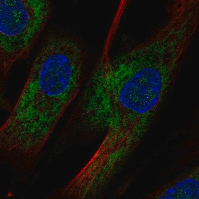 Anti-OMD antibody produced in rabbit