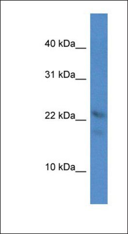 Anti-OMP antibody produced in rabbit